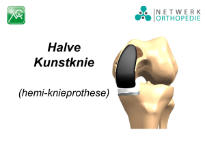 hemi-knieprothese - Netwerk Orthopedie