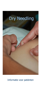 Dry Needling - Fysiotherapie van Lierop