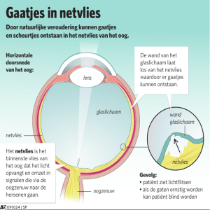 Gaatjes in netvlies