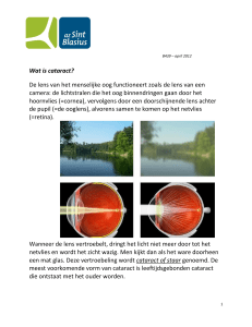 Wat is cataract? De lens van het menselijke oog functioneert zoals