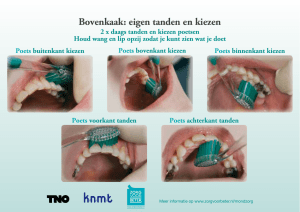 Bovenkaak: eigen tanden en kiezen