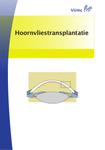 Hoornvliestransplantatie