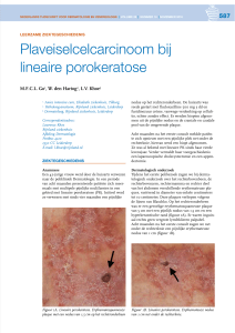 Plaveiselcelcarcinoom bij lineaire porokeratose