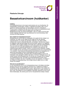Basaalcelcarcinoom (huidkanker) - Streekziekenhuis Koningin Beatrix
