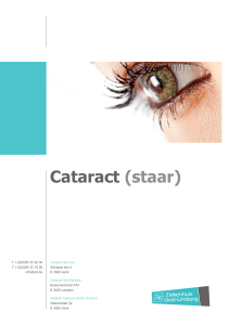 Cataract (staar) - Ziekenhuis Oost