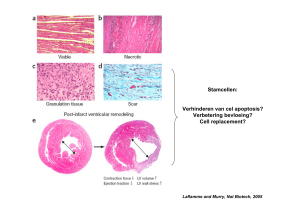 Stamcellen: Verhinderen van cel apoptosis? Verbetering bevloeing