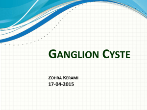 Ganglion Cyste Zohra Kerami 17-04-2015