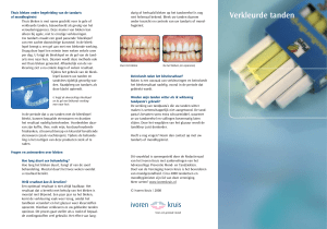 Verkleurde tanden - Laurenskwartier Tandheelkunde