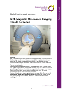 MRI (Magnetic Resonance Imaging) van de hersenen