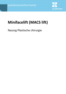 Minifacelift (MACS lift)