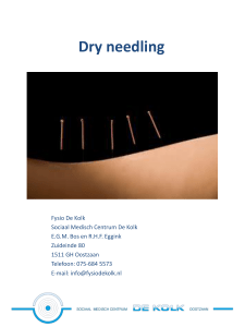 Dry needling - Fysio de Kolk