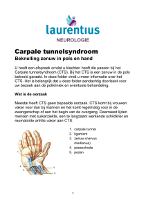 Carpale tunnelsyndroom - Laurentius Ziekenhuis Roermond