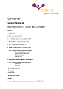 Endometriose - Baarmoederslijmvlies buiten de baarmoeder