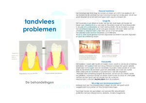 Tandvlees problemen - Tandartsengroepspraktijk Heemskerk