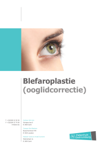 Blefaroplastie (ooglidcorrectie) - Ziekenhuis Oost