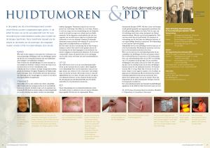Huidtumoren PDT - U