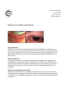 Blepharitis of Ooglidrandontsteking