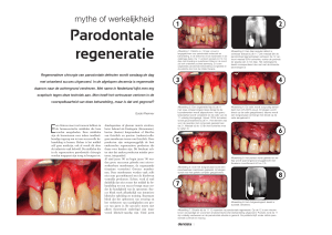 Parodontale regeneratie - Kliniek voor Parodontologie Amsterdam