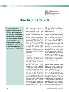 Uveïtis tuberculosa - KNCV Tuberculosefonds