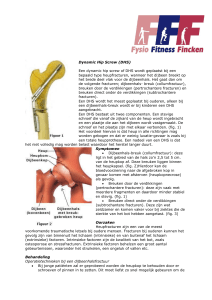 Dynamic Hip Screw - Fysio Fitness Fincken