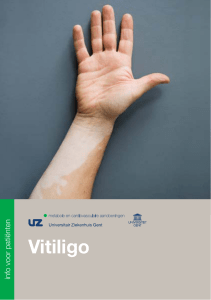 Vitiligo - UZ Gent