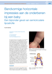 Bandvormige horizontale impressies aan de onderbenen bij