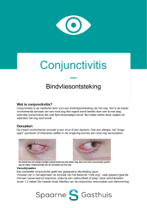 Bindvlies ontsteking van het oog (Conjunctivitis)