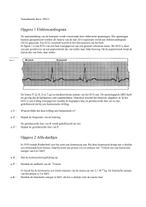 Opgave 1 Elektrocardiogram H92-I-1